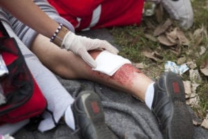 MN Burn Injury Attorney